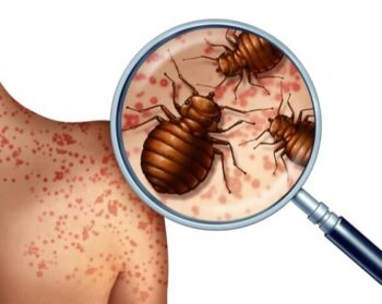 Why Do Bed Bugs Exist?