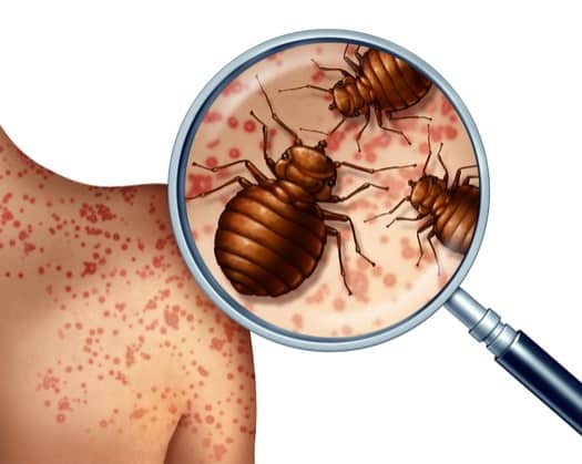 Image result for bed bugs