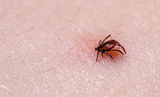 bed bugs vs. ticks